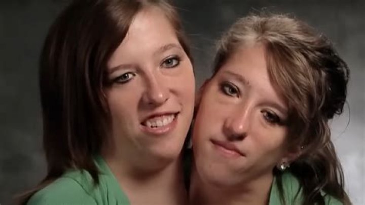 Abby Hensel Died: The Tragic End of a Conjoined Twins Life
